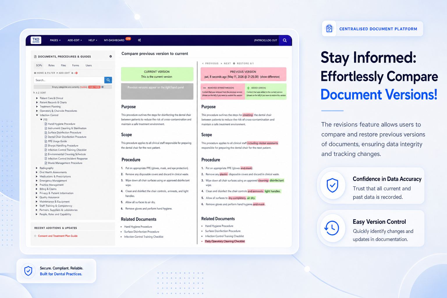 TKO Guides version comparison tool for dental documentation